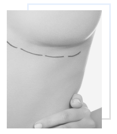 Breast Procedures 5050 IMG 4