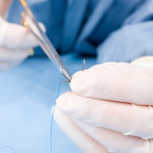 needle and thread for stitches
