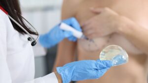 doctor holding a breast implant