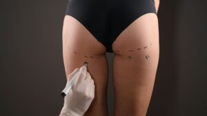Busting BBL Myths With Webb Plastic Surgery