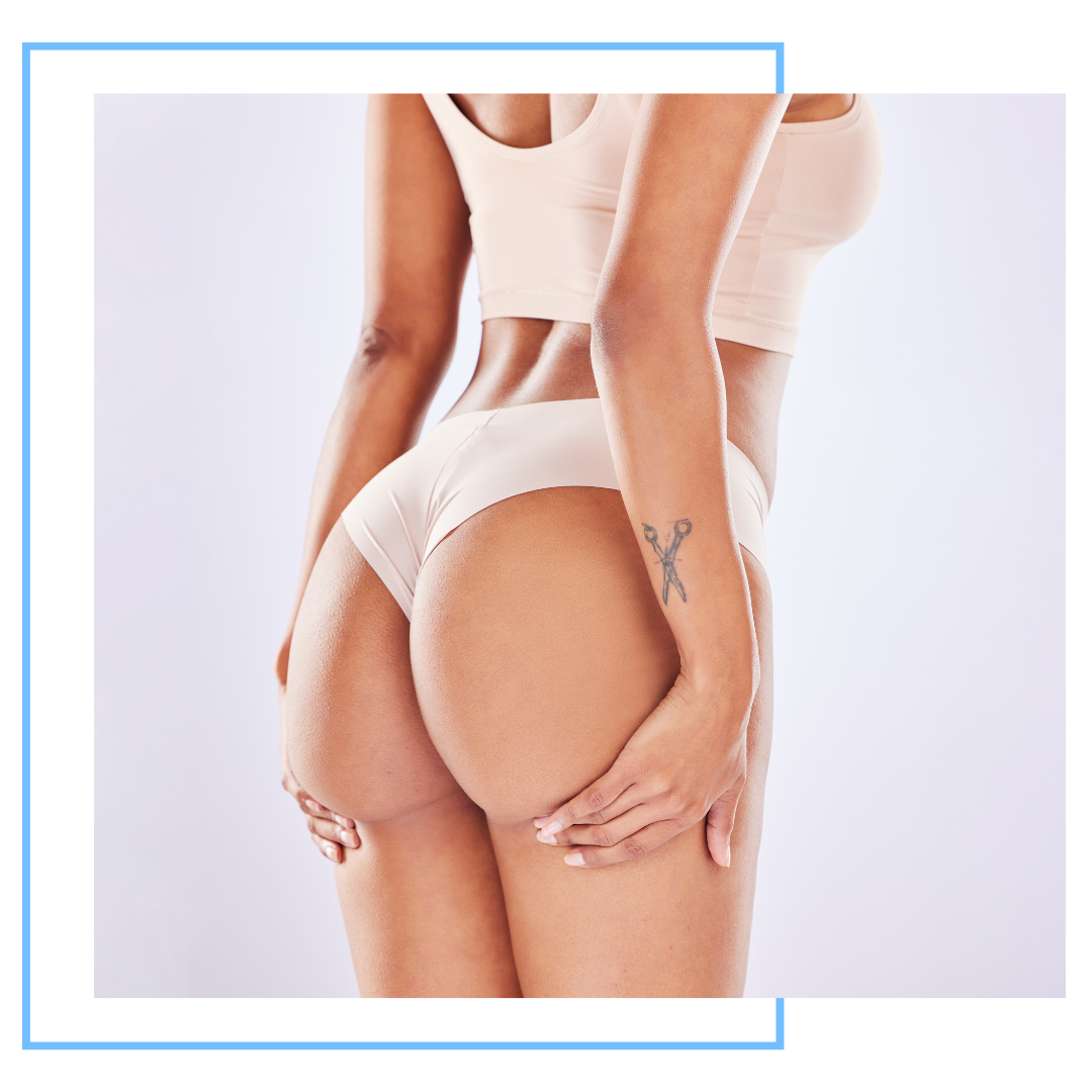 img of a butt lift