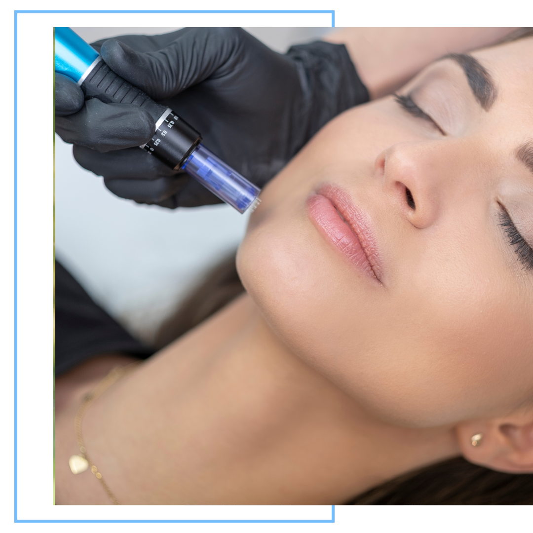 Microneedling1