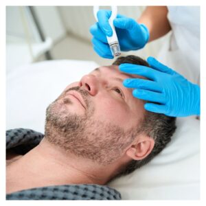 a man under going Microdermabrasion