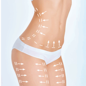 body contouring examples