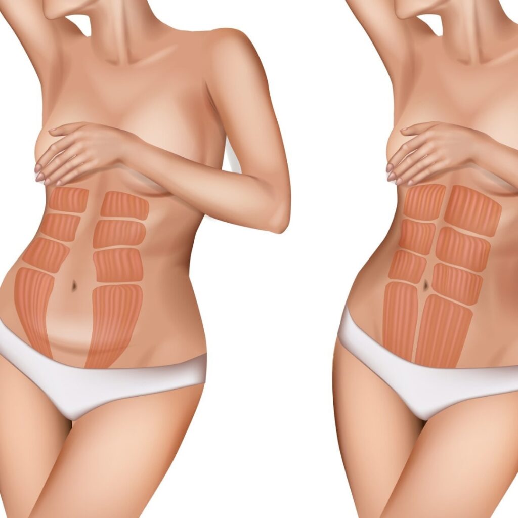 medical diagram