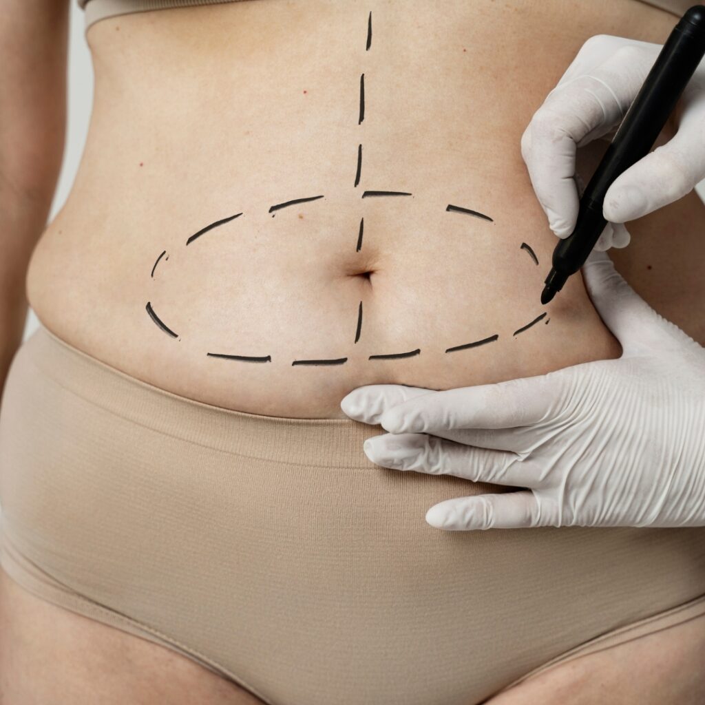 tracing a stomach